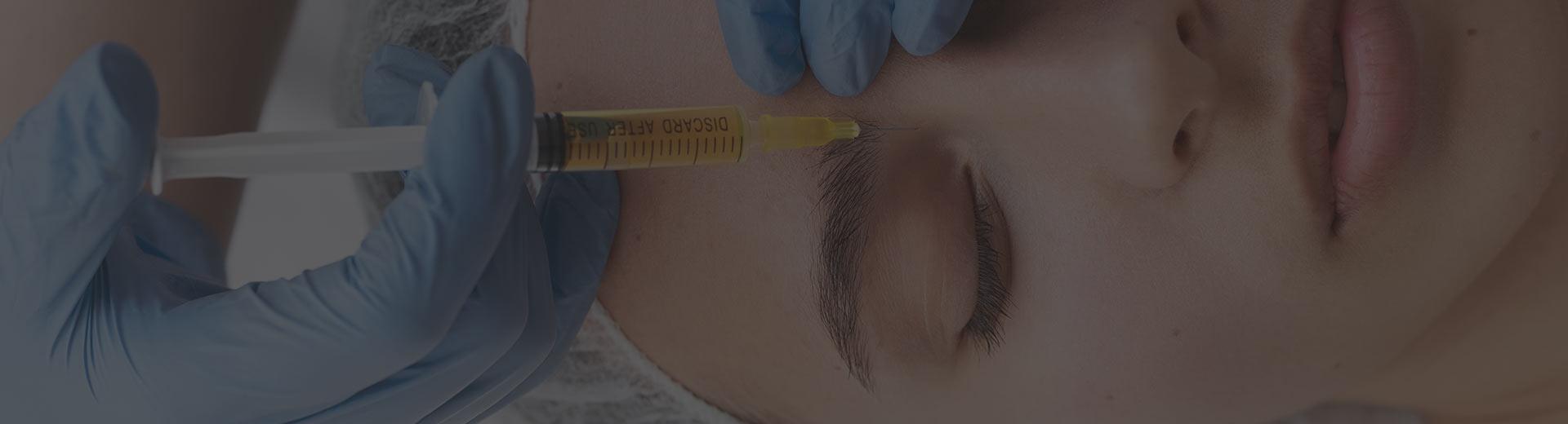 Bioestimuladores de colágeno